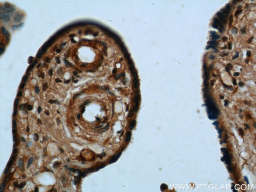 [12198-1-AP-150UL] UCN2 Polyclonal antibody