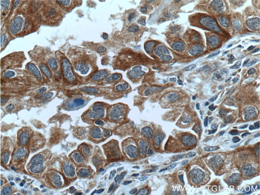 [12199-1-AP-150UL] USP25 Polyclonal antibody
