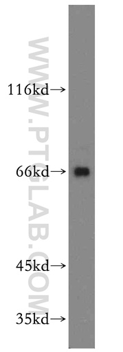 [12200-1-AP-20UL] ARMCX2 Polyclonal antibody