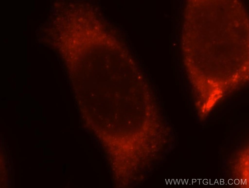 [12201-1-AP-20UL] ABHD5 Polyclonal antibody