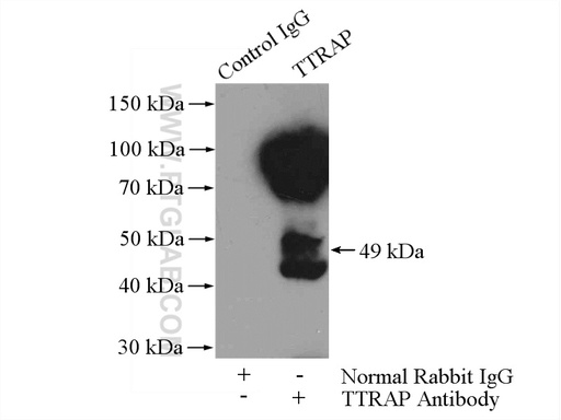 [12203-1-AP-20UL] TTRAP Polyclonal antibody