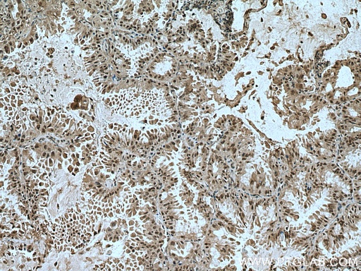 [12205-1-AP-20UL] TRIM27 Polyclonal antibody