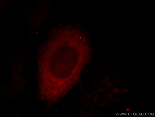 [12209-1-AP-20UL] CTRP1 Polyclonal antibody