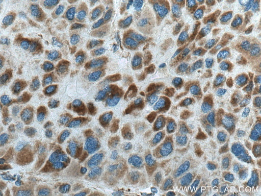 [12211-1-AP-20UL] CPOX Polyclonal antibody