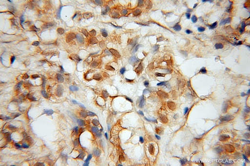 [12214-1-AP-20UL] MINA Polyclonal antibody