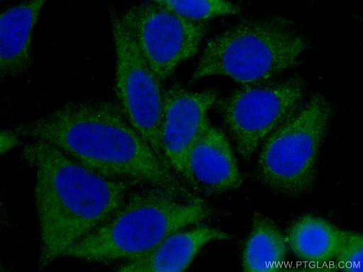 [12218-1-AP-20UL] PEPD Polyclonal antibody