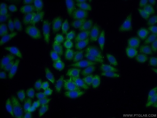 [12221-1-AP-20UL] BMP7 Polyclonal antibody