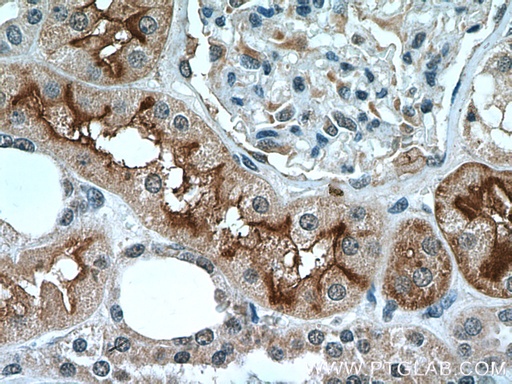 [12222-1-AP-20UL] DPEP1 Polyclonal antibody