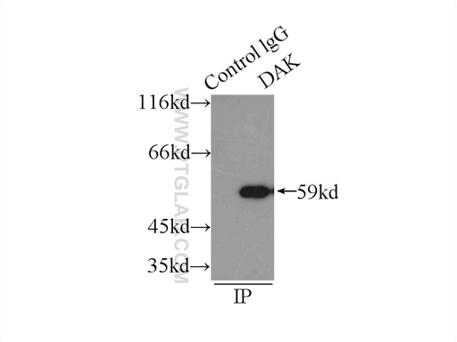 [12224-1-AP-150UL] DAK Polyclonal antibody