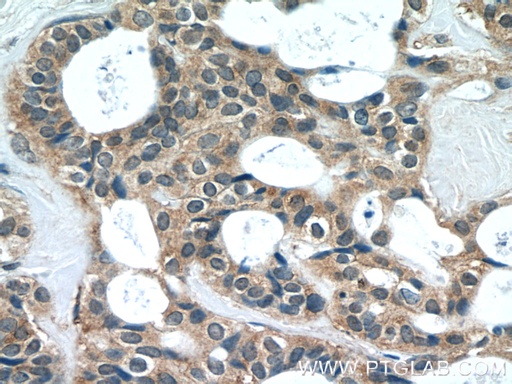 [12227-1-AP-150UL] EIF4E2 Polyclonal antibody