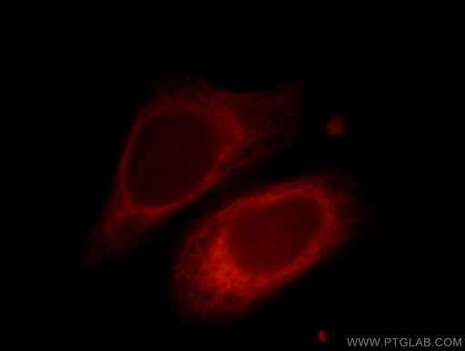 [12232-1-AP-20UL] PRKACB Polyclonal antibody