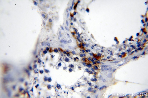 [12233-1-AP-150UL] MAGEA1 Polyclonal antibody