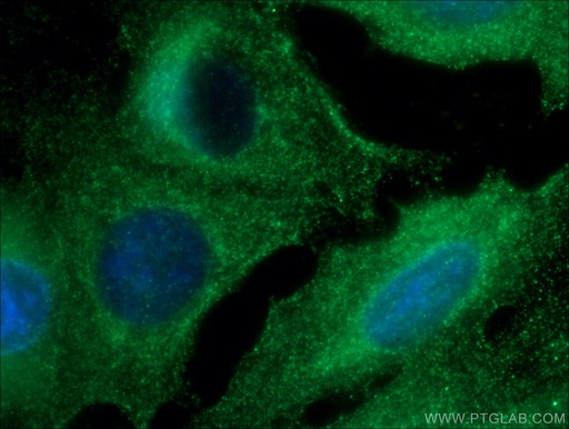 [12234-1-AP-150UL] RAB38 Polyclonal antibody