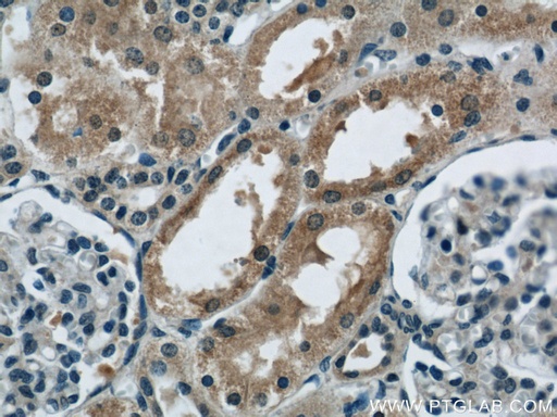 [12239-1-AP-150UL] CBY1 Polyclonal antibody