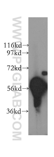 [12240-1-AP-150UL] DYRK1B Polyclonal antibody