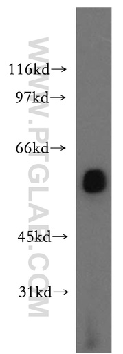 [12243-1-AP-150UL] LCAT Polyclonal antibody