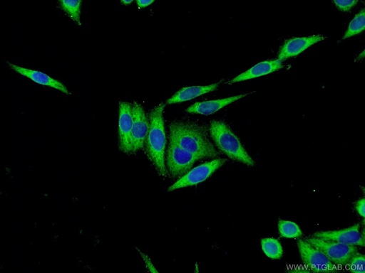 [12245-1-AP-150UL] Cystatin C Polyclonal antibody
