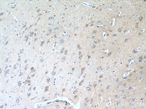 [12246-1-AP-20UL] TAGLN3 Polyclonal antibody