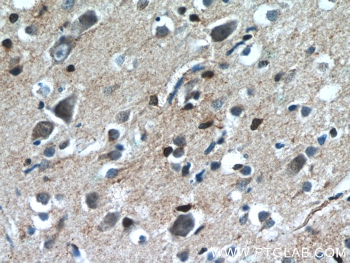 [12247-1-AP-150UL] CHURC1 Polyclonal antibody