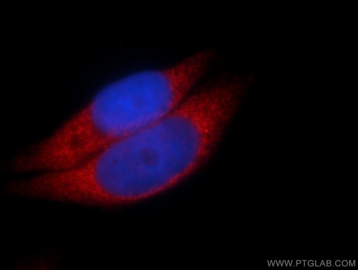 [12250-1-AP-20UL] Calpastatin Polyclonal antibody