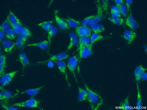 [12253-1-AP-150UL] SLC25A11 Polyclonal antibody