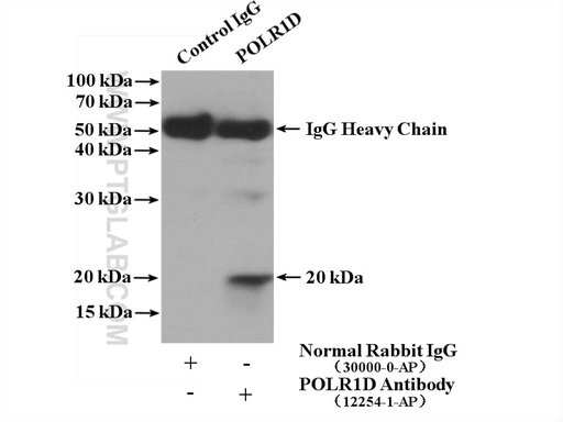 [12254-1-AP-150UL] POLR1D Polyclonal antibody