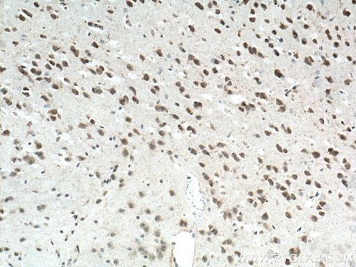 [12256-1-AP-20UL] NLRP1 Polyclonal antibody