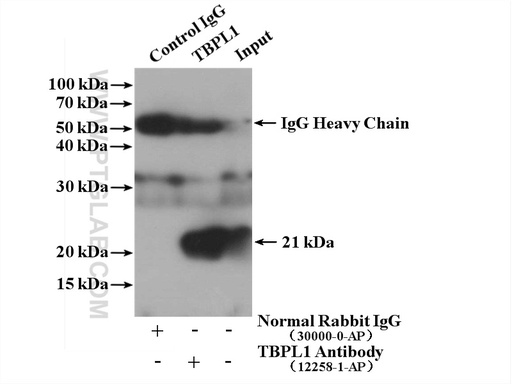 [12258-1-AP-150UL] TBPL1 Polyclonal antibody