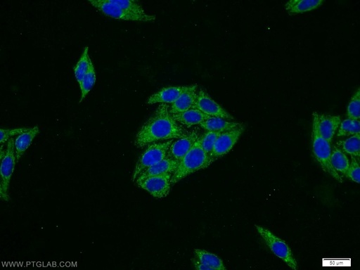 [12259-1-AP-20UL] SERPING1/C1 Inactivator Polyclonal antibody