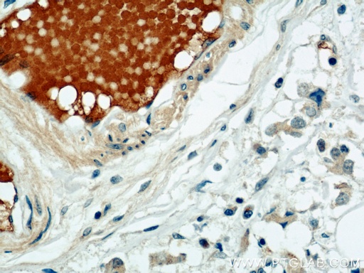 [12260-1-AP-150UL] SULF2 Polyclonal antibody