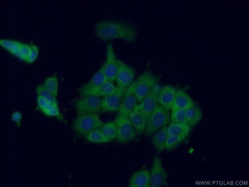 [12263-1-AP-20UL] CCT8 Polyclonal antibody
