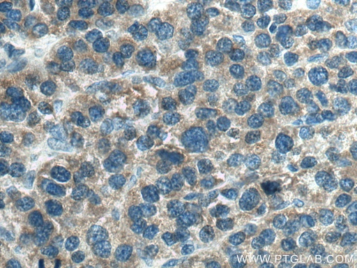 [12267-1-AP-150UL] PI16 Polyclonal antibody