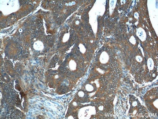 [12268-1-AP-150UL] REG4 Polyclonal antibody