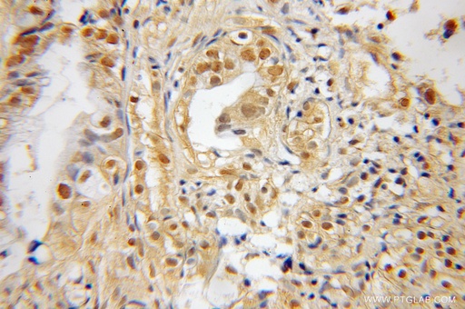[12269-1-AP-150UL] SNX7 Polyclonal antibody