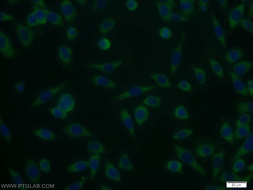 [12271-1-AP-150UL] UCK1 Polyclonal antibody