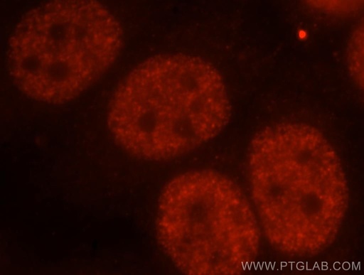 [12276-1-AP-150UL] FIP1L1 Polyclonal antibody