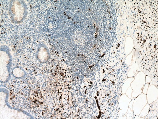 [12278-1-AP-20UL] Calretinin Polyclonal antibody