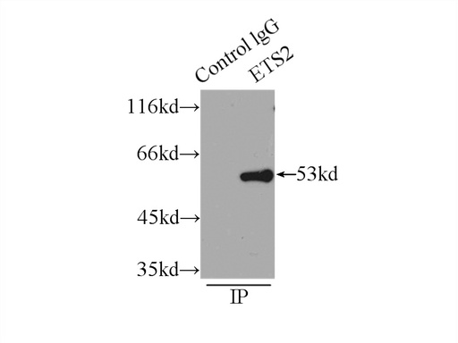[12280-1-AP-150UL] ETS2 Polyclonal antibody