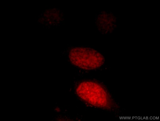 [12281-1-AP-150UL] LEO1 Polyclonal antibody
