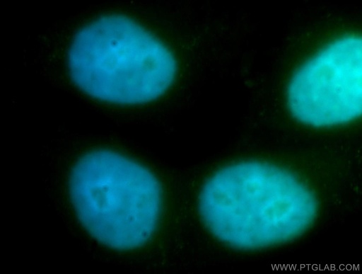 [12282-2-AP-150UL] ZWINT Polyclonal antibody
