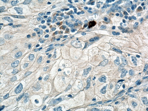 [12285-1-AP-20UL] PLXDC2 Polyclonal antibody