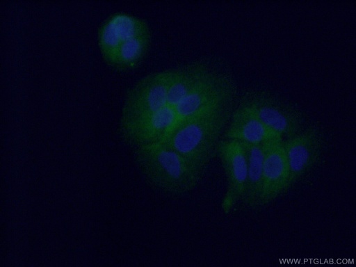 [12286-1-AP-20UL] CYP4F11 Polyclonal antibody