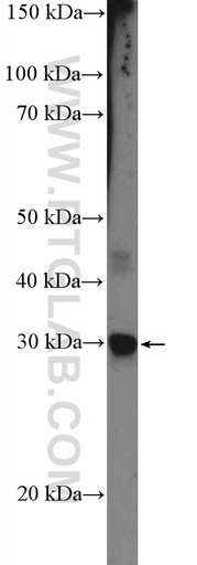 [12287-1-AP-150UL] CIDEC Polyclonal antibody