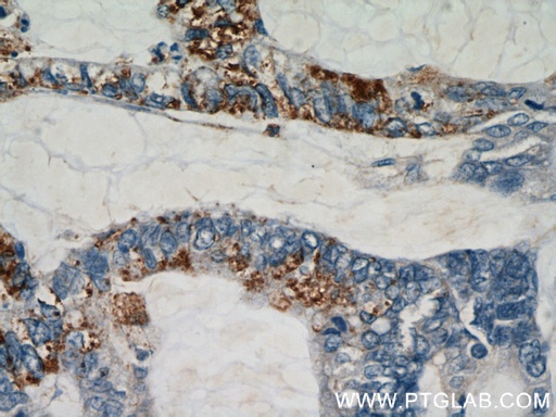 [12290-1-AP-20UL] RHOF Polyclonal antibody