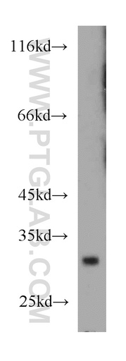 [12293-1-AP-20UL] TSPAN6 Polyclonal antibody