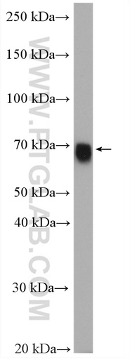 [12294-1-AP-150UL] GATAD2A Polyclonal antibody