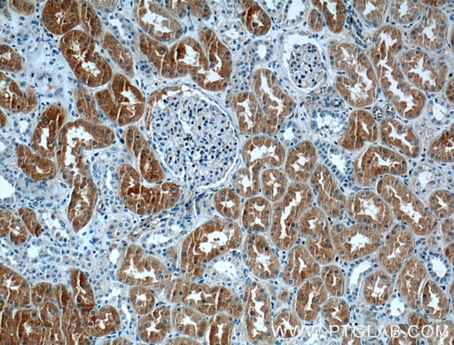 [12298-2-AP-20UL] CLIC4 Polyclonal antibody