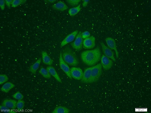[12300-1-AP-20UL] ITGB1BP1 Polyclonal antibody