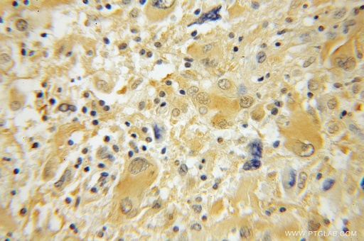 [12302-1-AP-150UL] ACYP2 Polyclonal antibody