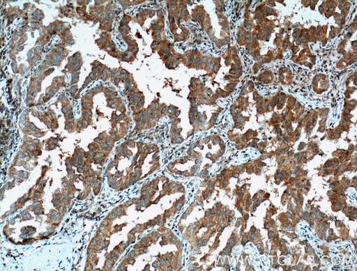 [12303-1-AP-150UL] PDCD6 Polyclonal antibody